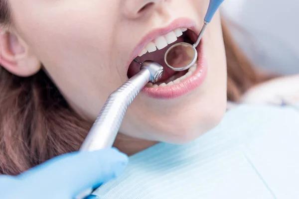 Skilled Denver Pediatric Dentist for Safe Dental Treatments